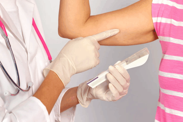 Birth Control Implant in Edmonton: What to Know Before You Choose a Subdermal Implant